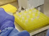 SP confirma segundo caso importado de sarampo